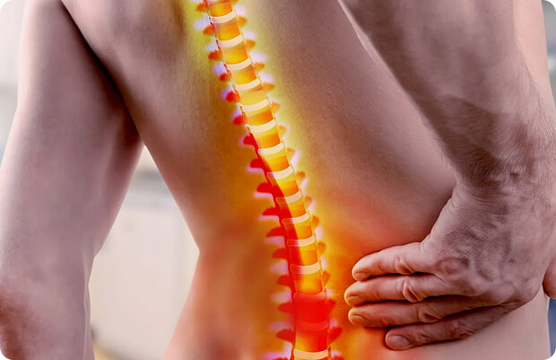 prikaz bolečine v hrtbu kako izgleda, kjer je najhuje je označeno s temno rdečo